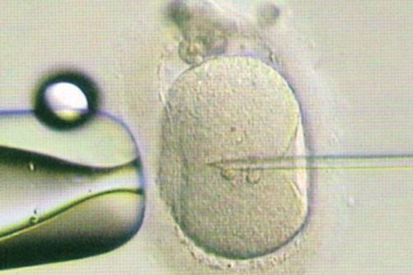 如何对胚胎选择 试管婴儿妊娠率高的医院