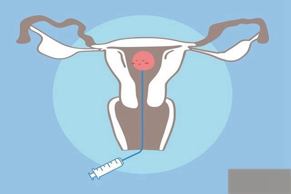 没有卵巢的妇女能通过试管婴儿怀孕吗？